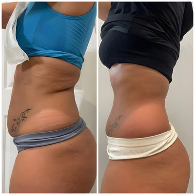 Sculpta™ 4-in-1 Body Sculpt Device