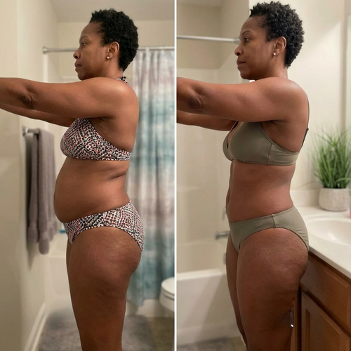 Sculpta™ 4-in-1 Body Sculpt Device